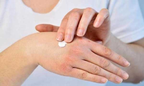 Каких витаминов и полезных жиров не хватает в организме при сухости кожи и цыпках на руках