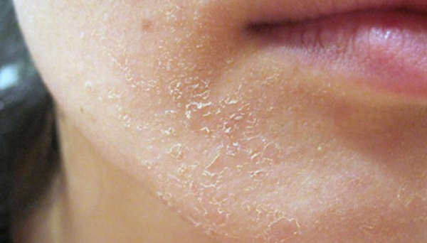 Признаки неухоженной кожи лица, которые портят внешний вид